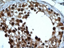 KDM1 Rabbit anti-Human, Mouse, Polyclonal, Proteintech 150 &mu;L; Unconjugated:Antibodies,