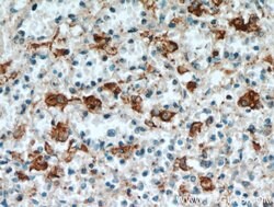 SGSM3 Rabbit anti-Human, Mouse, Polyclonal, Proteintech 150 &mu;L; Unconjugated:Antibodies,