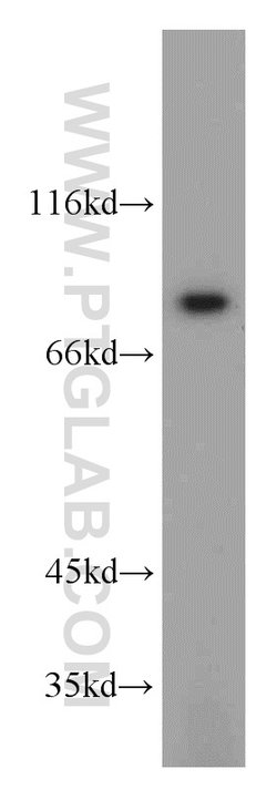 SGSM3 Rabbit anti-Human, Mouse, Polyclonal, Proteintech 150 &mu;L; Unconjugated:Antibodies,