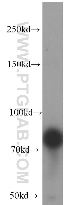 SGSM3 Rabbit anti-Human, Mouse, Polyclonal, Proteintech 150 &mu;L; Unconjugated:Antibodies,