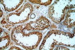 CCDC42 Rabbit anti-Human, Mouse, Rat, Polyclonal, Proteintech:Antibodies:Primary