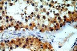 CCDC42 Rabbit anti-Human, Mouse, Rat, Polyclonal, Proteintech:Antibodies:Primary