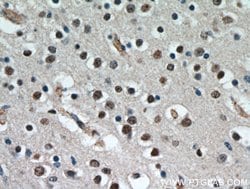 CCDC42 Rabbit anti-Human, Mouse, Rat, Polyclonal, Proteintech:Antibodies:Primary
