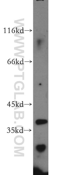 CCDC42 Rabbit anti-Human, Mouse, Rat, Polyclonal, Proteintech:Antibodies:Primary