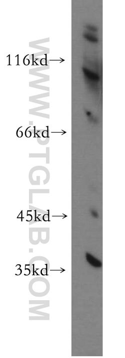 CCDC42 Rabbit anti-Human, Mouse, Rat, Polyclonal, Proteintech:Antibodies:Primary