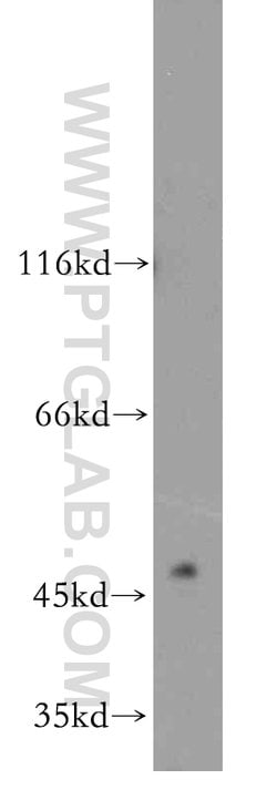 GABPB2 Rabbit anti-Human, Mouse, Rat, Polyclonal, Proteintech:Antibodies:Primary