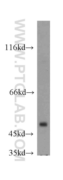 GABPB2 Rabbit anti-Human, Mouse, Rat, Polyclonal, Proteintech:Antibodies:Primary