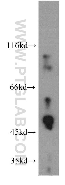 GABPB2 Rabbit anti-Human, Mouse, Rat, Polyclonal, Proteintech:Antibodies:Primary