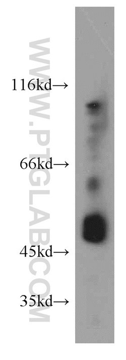 GABPB2 Rabbit anti-Human, Mouse, Rat, Polyclonal, Proteintech:Antibodies:Primary