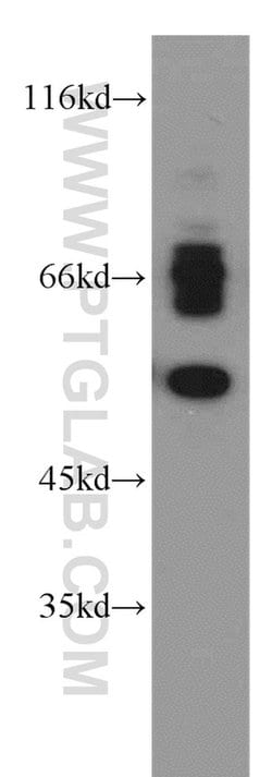 VMAT2 Rabbit anti-Human, Polyclonal, Proteintech:Anticuerpos:Anticuerpos