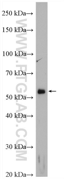 VMAT2 Rabbit anti-Human, Polyclonal, Proteintech:Anticuerpos:Anticuerpos