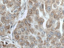TTC19 Rabbit anti-Human, Mouse, Polyclonal, Proteintech:Antibodies:Primary