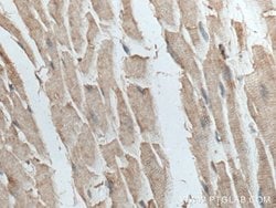 TTC19 Rabbit anti-Human, Mouse, Polyclonal, Proteintech:Antibodies:Primary