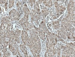 TTC19 Rabbit anti-Human, Mouse, Polyclonal, Proteintech:Antibodies:Primary