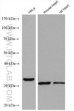 TTC19 Rabbit anti-Human, Mouse, Polyclonal, Proteintech:Antibodies:Primary