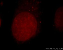 CUL4B Rabbit anti-Human, Mouse, Rat, Polyclonal, Proteintech:Antibodies:Primary