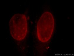 CUL4B Rabbit anti-Human, Mouse, Rat, Polyclonal, Proteintech:Antibodies:Primary