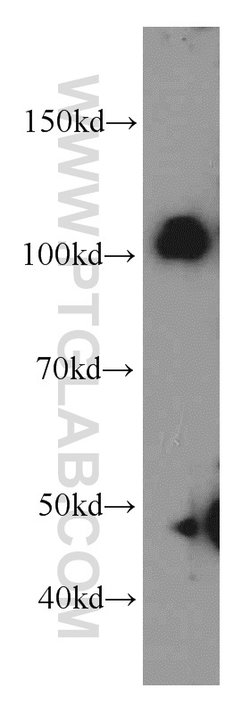 CUL4B Rabbit anti-Human, Mouse, Rat, Polyclonal, Proteintech:Antibodies:Primary