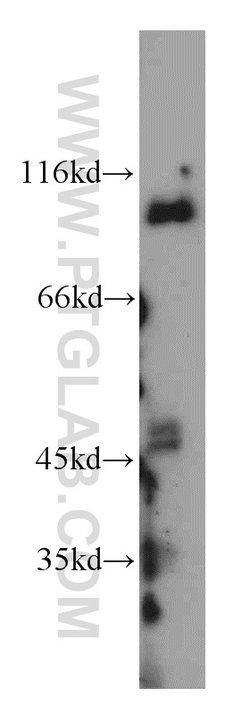 CUL4B Rabbit anti-Human, Mouse, Rat, Polyclonal, Proteintech:Antibodies:Primary