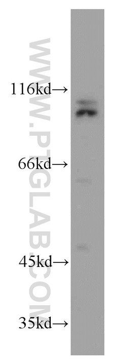 CUL4B Rabbit anti-Human, Mouse, Rat, Polyclonal, Proteintech:Antibodies:Primary