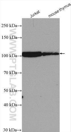 CUL4B Rabbit anti-Human, Mouse, Rat, Polyclonal, Proteintech:Antibodies:Primary