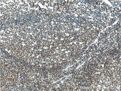 CUL4B Rabbit anti-Human, Mouse, Rat, Polyclonal, Proteintech:Antibodies:Primary