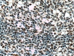 CUL4B Rabbit anti-Human, Mouse, Rat, Polyclonal, Proteintech:Antibodies:Primary
