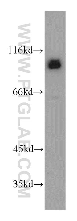 CUL4B Rabbit anti-Human, Mouse, Rat, Polyclonal, Proteintech:Antibodies:Primary