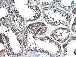 SDF2L1 Rabbit anti-Human, Mouse, Rat, Polyclonal, Proteintech 20 &mu;L;