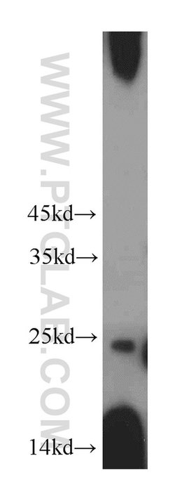 SDF2L1 Rabbit anti-Human, Mouse, Rat, Polyclonal, Proteintech 20 &mu;L;