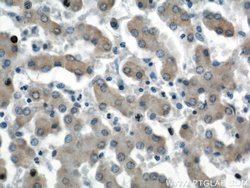 SEC23IP Rabbit anti-Human, Mouse, Rat, Polyclonal, Proteintech:Antibodies:Primary