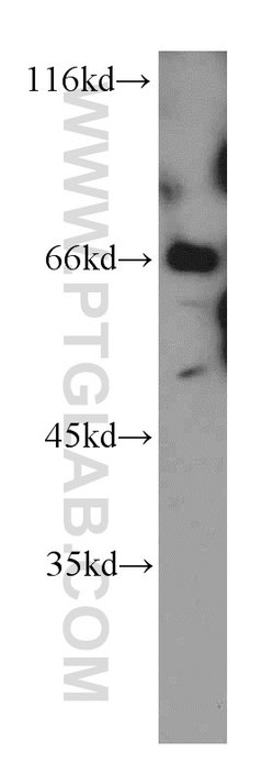 E-selectin /CD62E Rabbit anti-Human, Mouse, Rat, Polyclonal, Proteintech:Antibodies:Primary