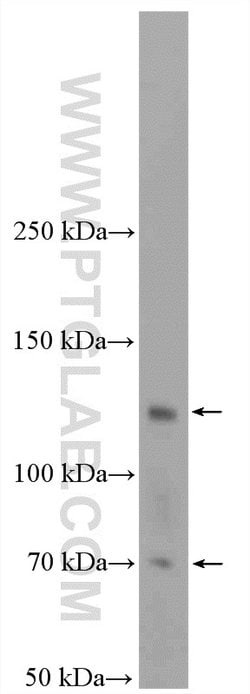 E-selectin /CD62E Rabbit anti-Human, Mouse, Rat, Polyclonal, Proteintech:Antibodies:Primary
