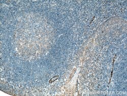 E-selectin /CD62E Rabbit anti-Human, Mouse, Rat, Polyclonal, Proteintech:Antibodies:Primary