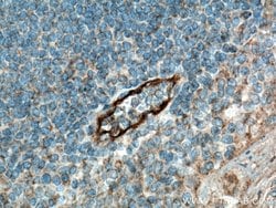 E-selectin /CD62E Rabbit anti-Human, Mouse, Rat, Polyclonal, Proteintech:Antibodies:Primary