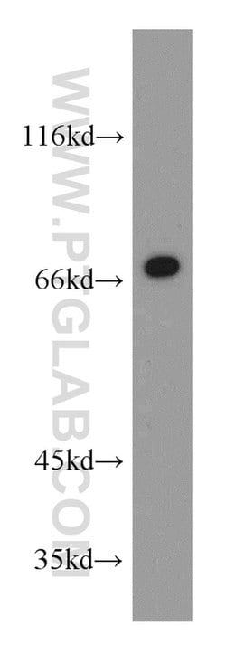 E-selectin /CD62E Rabbit anti-Human, Mouse, Rat, Polyclonal, Proteintech:Antibodies:Primary