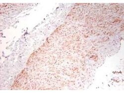 TNF alpha Polyclonal Antibody, Rockland 1 mg; Unconjugated:Antibodies,