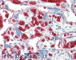 Red Blood Cell Polyclonal Antibody, Rockland 50 mg; Unconjugated:Antibodies,