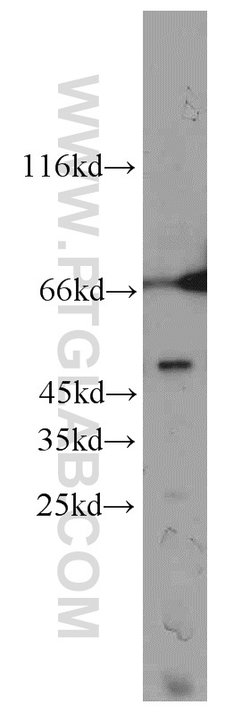 CCDC83 Rabbit anti-Human, Polyclonal, Proteintech 20 &mu;L; Unconjugated:Antibodies,
