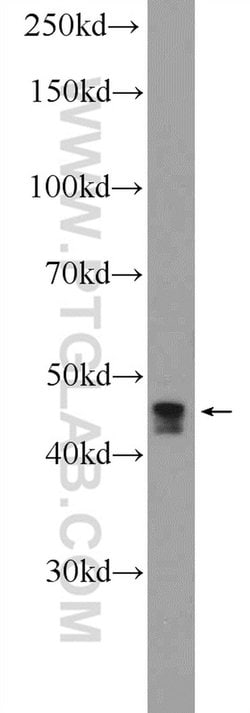 CCDC83 Rabbit anti-Human, Polyclonal, Proteintech 20 &mu;L; Unconjugated:Antibodies,
