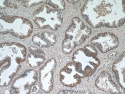 C3orf21 Rabbit anti-Human, Mouse, Rat, Polyclonal, Proteintech 150 μL;