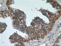 C3orf21 Rabbit anti-Human, Mouse, Rat, Polyclonal, Proteintech 150 μL;