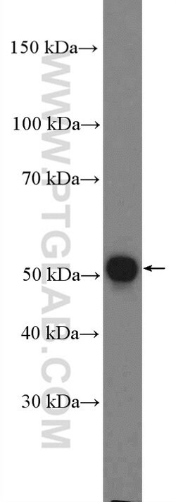 LRRC17 Rabbit anti-Human, Mouse, Polyclonal, Proteintech 20 &mu;L; Unconjugated:Antibodies,