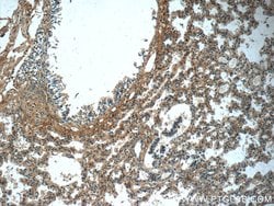 PTAFR Rabbit anti-Human, Polyclonal, Proteintech 150 &mu;L; Unconjugated:Antibodies,