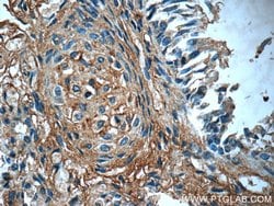 PTAFR Rabbit anti-Human, Polyclonal, Proteintech 150 &mu;L; Unconjugated:Antibodies,