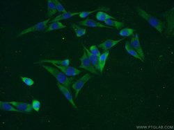 C7orf58 Rabbit anti-Human, Polyclonal, Proteintech 150 &mu;L; Unconjugated:Antibodies,