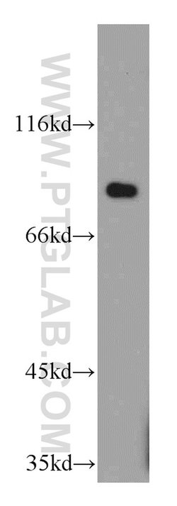 C7orf58 Rabbit anti-Human, Polyclonal, Proteintech 150 &mu;L; Unconjugated:Antibodies,