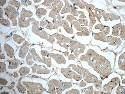 DPCD Rabbit anti-Human, Mouse, Rat, Polyclonal, Proteintech:Antibodies:Primary