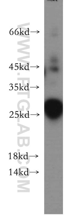 DPCD Rabbit anti-Human, Mouse, Rat, Polyclonal, Proteintech:Antibodies:Primary