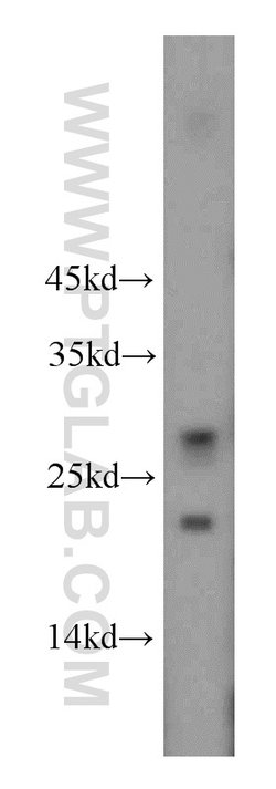 DPCD Rabbit anti-Human, Mouse, Rat, Polyclonal, Proteintech:Antibodies:Primary